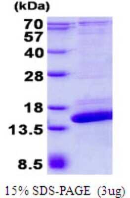 SDS-PAGE: Recombinant Human SH3BGRL2 His Protein [NBP2-23465]