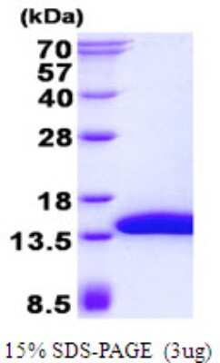 SDS-PAGE: Recombinant Human SH3BGRL3 His Protein [NBP2-23466]