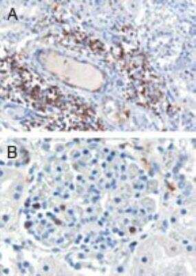 Immunohistochemistry-Paraffin: SH3BP1 Antibody [NB100-1398]