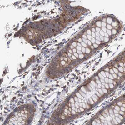 Immunohistochemistry-Paraffin: SH3BP1 Antibody [NBP1-88827]