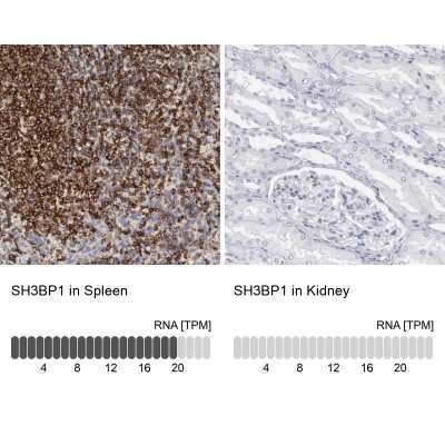 Immunohistochemistry-Paraffin: SH3BP1 Antibody [NBP1-88827]