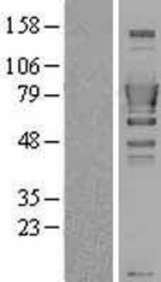 Western Blot: SH3BP1 Overexpression Lysate [NBL1-15926]