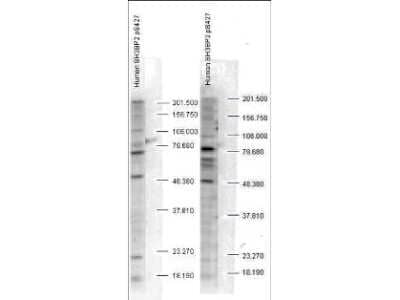 Western Blot: SH3BP2 [p Ser427] Antibody [NB600-492]