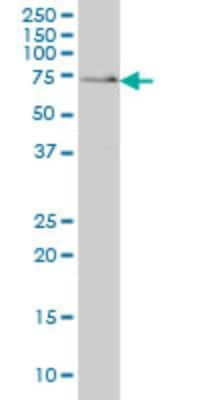 Western Blot: SH3BP2 Antibody (1E9) [H00006452-M01]