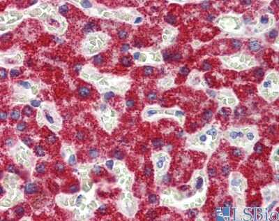 Immunohistochemistry: SH3BP2 Antibody [NBP1-58872]