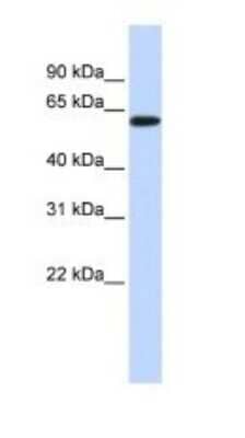 Western Blot: SH3BP2 Antibody [NBP1-58872]