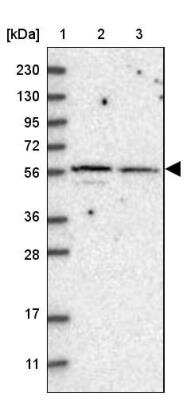 Western Blot: SH3BP2 Antibody [NBP1-85458]