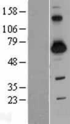 Western Blot: SH3BP2 Overexpression Lysate [NBP2-09407]