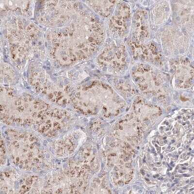 Immunohistochemistry-Paraffin: SH3BP5 Antibody [NBP1-80796]