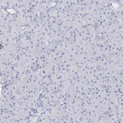 Immunohistochemistry-Paraffin: SH3BP5 Antibody [NBP1-80796]