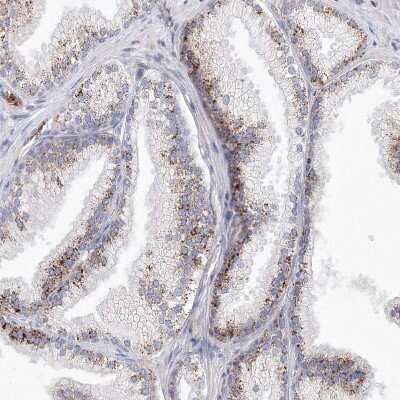 Immunohistochemistry-Paraffin: SH3BP5 Antibody [NBP1-80796]