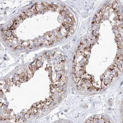 Immunohistochemistry-Paraffin: SH3BP5 Antibody [NBP1-80796]