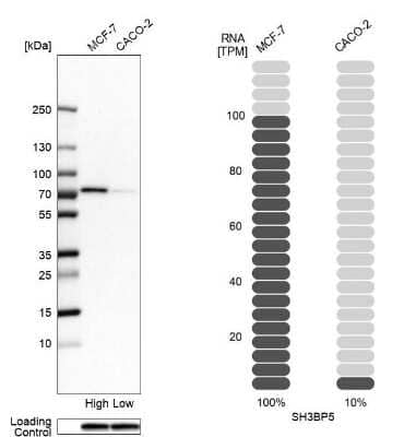 Western Blot: SH3BP5 Antibody [NBP1-80796]