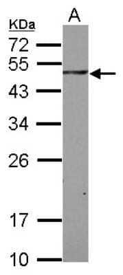 Western Blot: SH3BP5 Antibody [NBP2-20343]