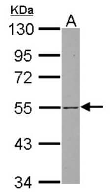 Western Blot: SH3BP5 Antibody [NBP2-20344]