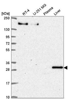 Western Blot: SH3BP5 Antibody [NBP2-58311]