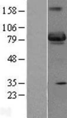 Western Blot: SH3BP5 Overexpression Lysate [NBP2-07817]