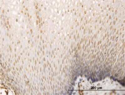 Immunohistochemistry-Paraffin: SH3D19 Antibody (5C7) [H00152503-M01]
