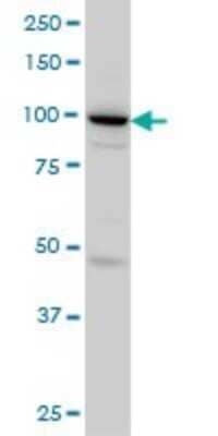 Western Blot: SH3D19 Antibody (5C7) [H00152503-M01]