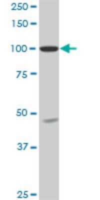 Western Blot: SH3D19 Antibody (5C7) [H00152503-M01]