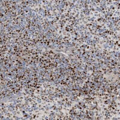 Immunohistochemistry-Paraffin: SH3D19 Antibody [NBP1-84203]