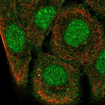 Immunocytochemistry/ Immunofluorescence: SH3D21 Antibody [NBP2-57117]