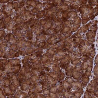 Immunohistochemistry-Paraffin: SH3D21 Antibody [NBP1-94120]