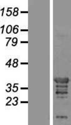 Western Blot: Endophilin A1/SH3GL2 Overexpression Lysate [NBP2-08045]