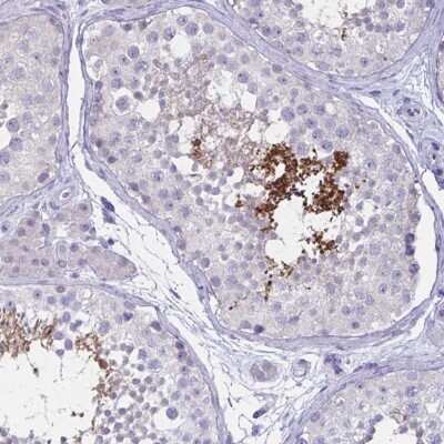 Immunohistochemistry-Paraffin: SH3GL3 Antibody [NBP1-84419]