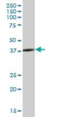 Western Blot: SH3GL3 Antibody [H00006457-B01P]