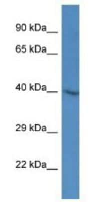 Western Blot: SH3GL3 Antibody [NBP1-79630]