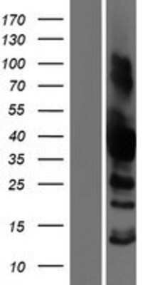 Western Blot: SH3GL3 Overexpression Lysate [NBP2-08046]