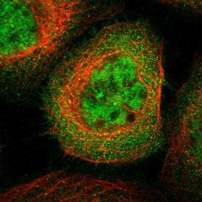 Immunocytochemistry/ Immunofluorescence: SH3GLB2 Antibody [NBP1-81367]