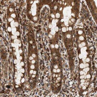 Immunohistochemistry: SH3GLB2 Antibody [NBP1-81367]