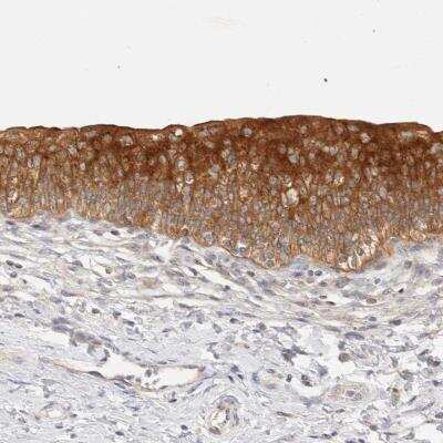 Immunohistochemistry: SH3GLB2 Antibody [NBP1-81368]