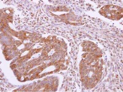 Immunohistochemistry-Paraffin: SH3GLB2 Antibody [NBP2-20346]