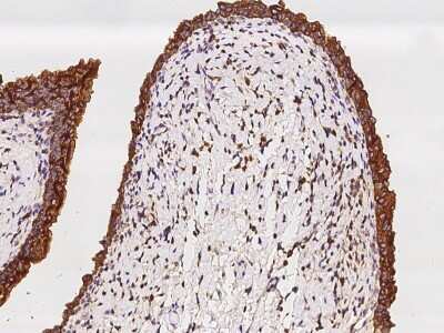 Immunohistochemistry-Paraffin: SH3GLB2 Antibody [NBP2-97456]