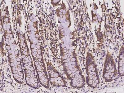 Immunohistochemistry-Paraffin: SH3GLB2 Antibody [NBP2-97456]