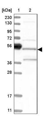 Western Blot: SH3GLB2 Antibody [NBP1-81367]