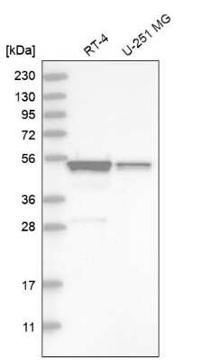 Western Blot: SH3GLB2 Antibody [NBP1-81368]