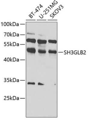 Western Blot: SH3GLB2 AntibodyBSA Free [NBP3-04587]