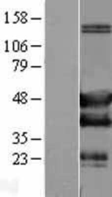 Western Blot: SH3GLB2 Overexpression Lysate [NBL1-15934]