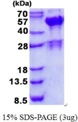 SDS-PAGE: Recombinant Human SH3GLB2 His Protein [NBP2-23468]