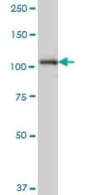 Western Blot: SH3MD2 Antibody (3H3) [H00057630-M01]