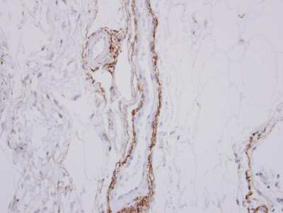 Immunohistochemistry-Paraffin: SH3MD2 Antibody [NBP2-20347]