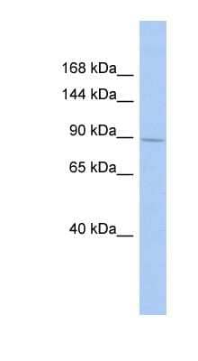 Western Blot: SH3MD2 Antibody [NBP1-54972]