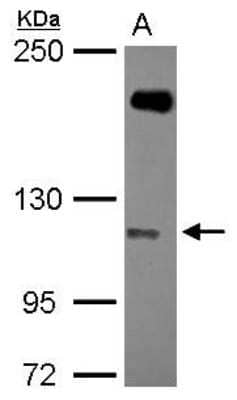 Western Blot: SH3MD2 Antibody [NBP2-20347]