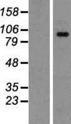 Western Blot: SH3MD2 Overexpression Lysate [NBP2-06597]