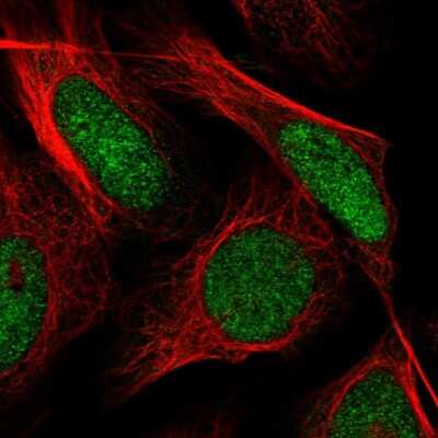 Immunocytochemistry/ Immunofluorescence: SH3MD4 Antibody [NBP2-31028]