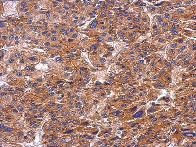 Immunohistochemistry-Paraffin: SH3PX1 Antibody [NBP2-20348]